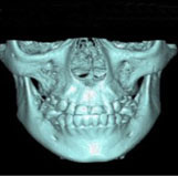 Essentials of 3D radiology